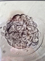 FET #1 - Embryo #1