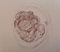 FET #2 - Embryo #2