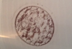 FET #2 - Embryo #3