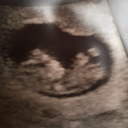 10w4d A lovely wriggly baby