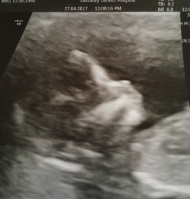 13w4d - The most beautiful face I have ever seen